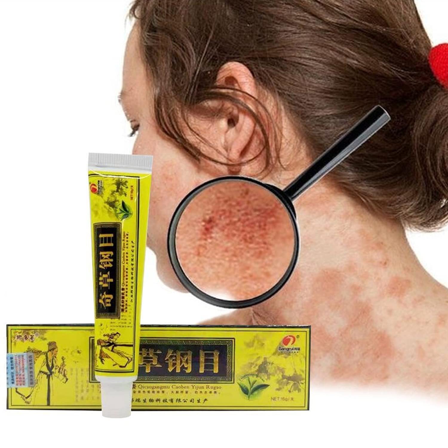 5Pcs/Lot Chinese Herbal Eczema, Psoriasis Creams Dermatitis and Eczema