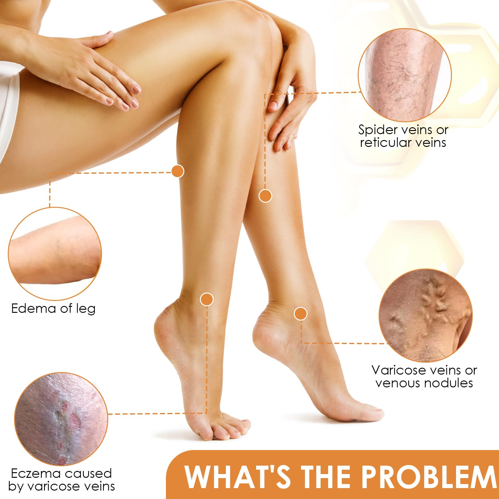 Crème pour Contre les Varices au Venin d'Abeille, Crème de Traitement des Varices au Venin d'abeille, Pommade de Récupération au Venin d'abeille pour les Jambes, Convient à Tous Les Types De Peau, 60g