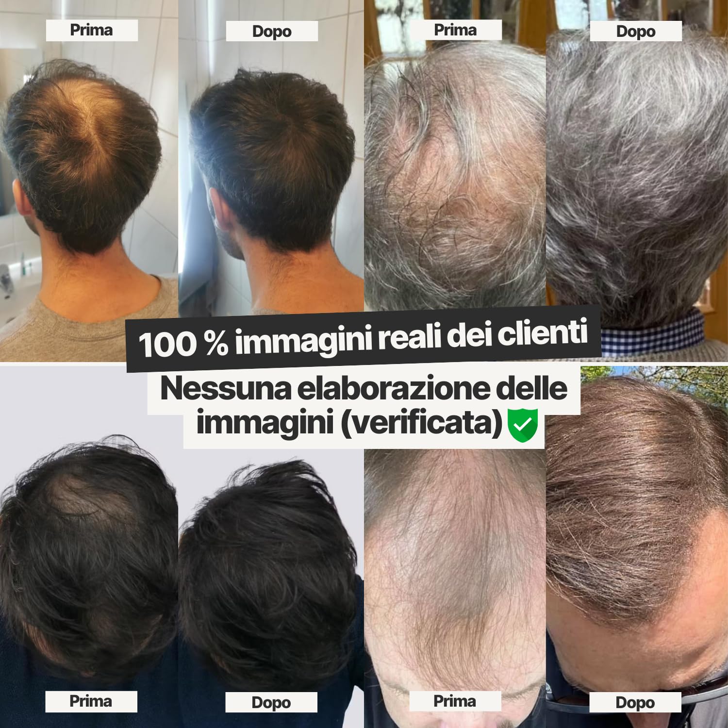 IMPERIO Fibre capelli - per l'infoltimento dei capelli per capelli più spessi e pieni in pochi secondi. Nasconde la caduta dei capelli nelle donne e negli uomini. 100% naturale. 26g (castano scuro)