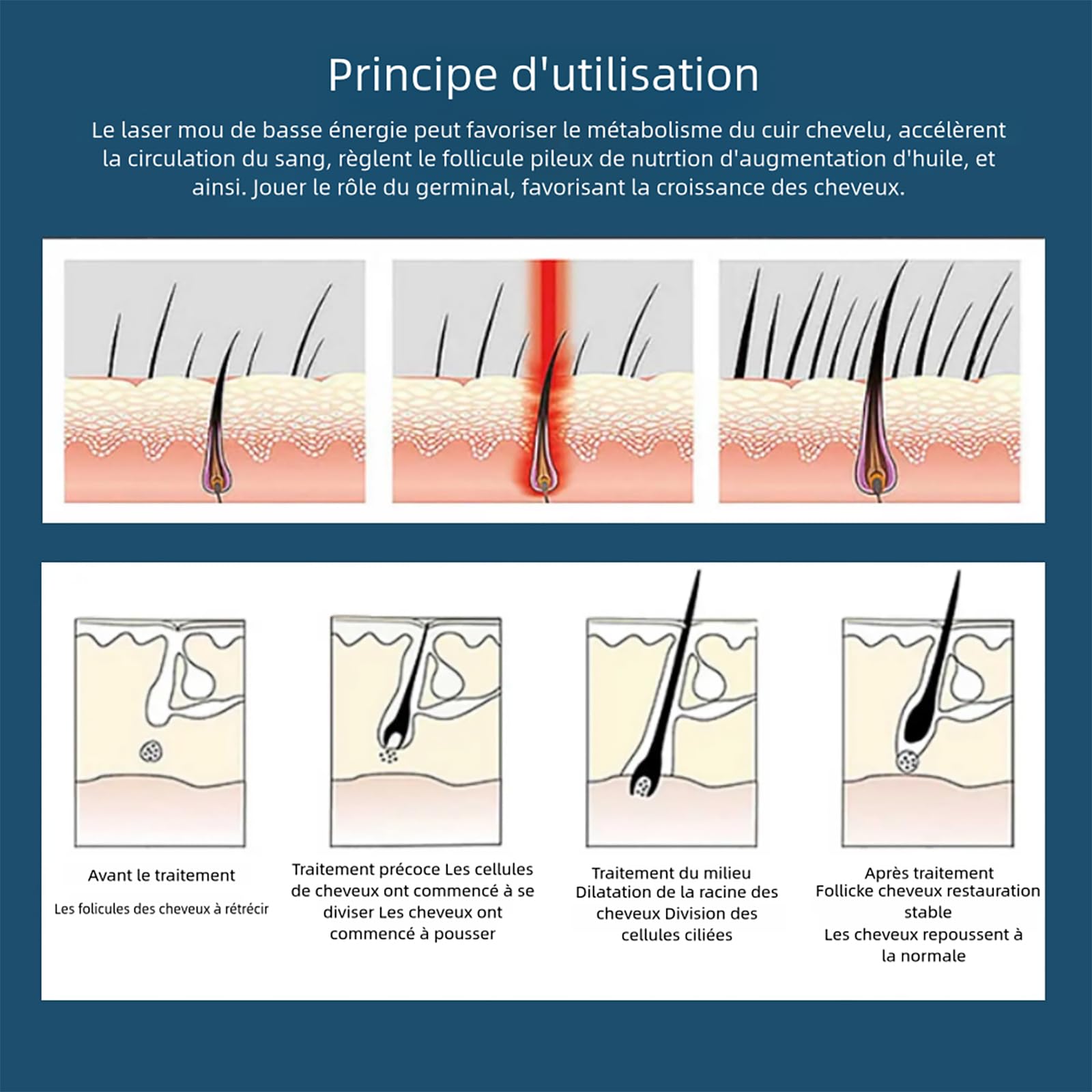 Thérapie par la Lumière Rouge et Infrarouge et pour la Repousse des Cheveux Chapeau de Luminothérapie Lampe Infrarouge Red Light Therapy pour la Perte de Cheveux Douleur(Plug-in noir)