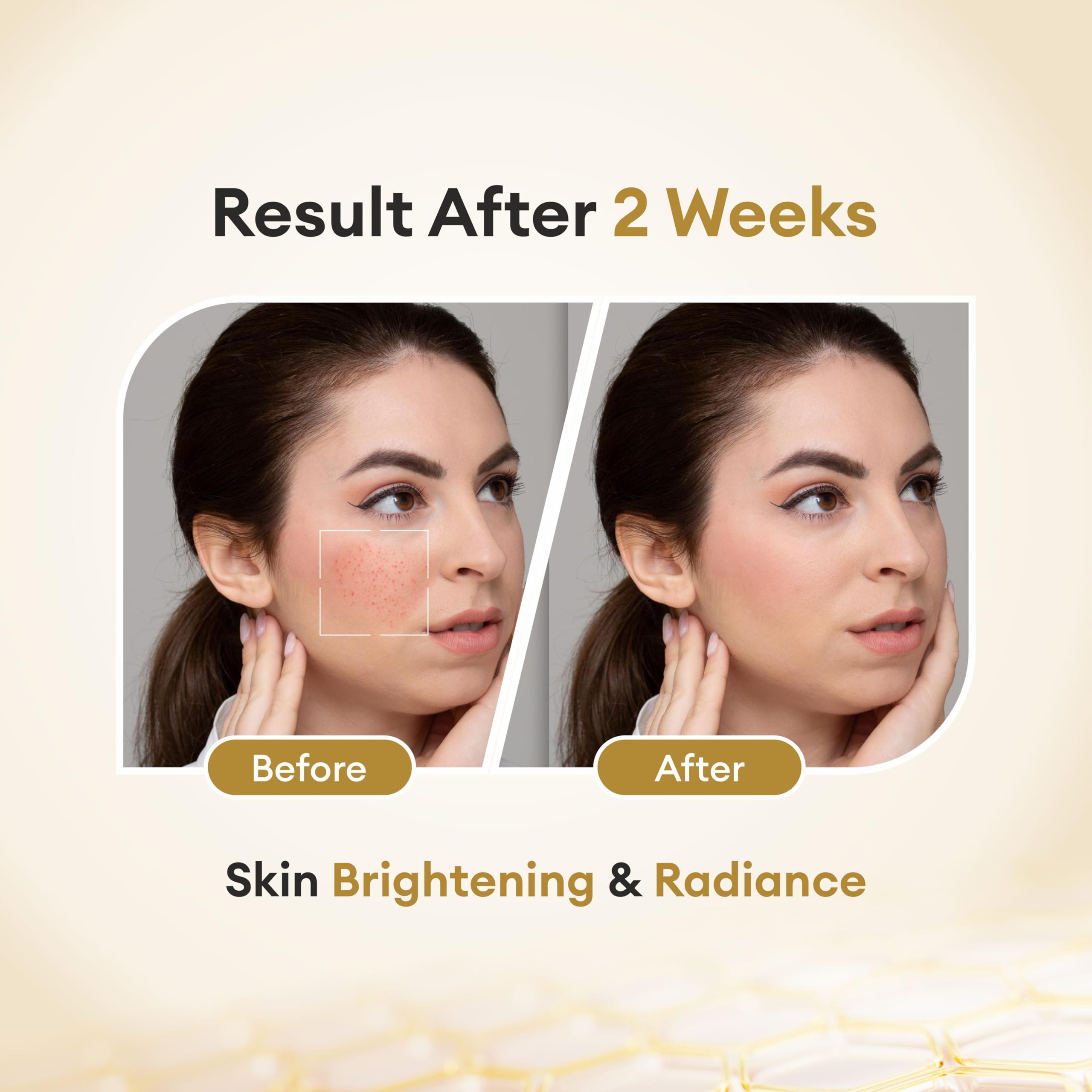 glutathione skin brightening results 8527808101: IV Drip is now available at Dr. Kasanas Clinic for just 3500. Glutathione therapy is known for helping improve brightness and overall skin health. However, it is The amazing results of our