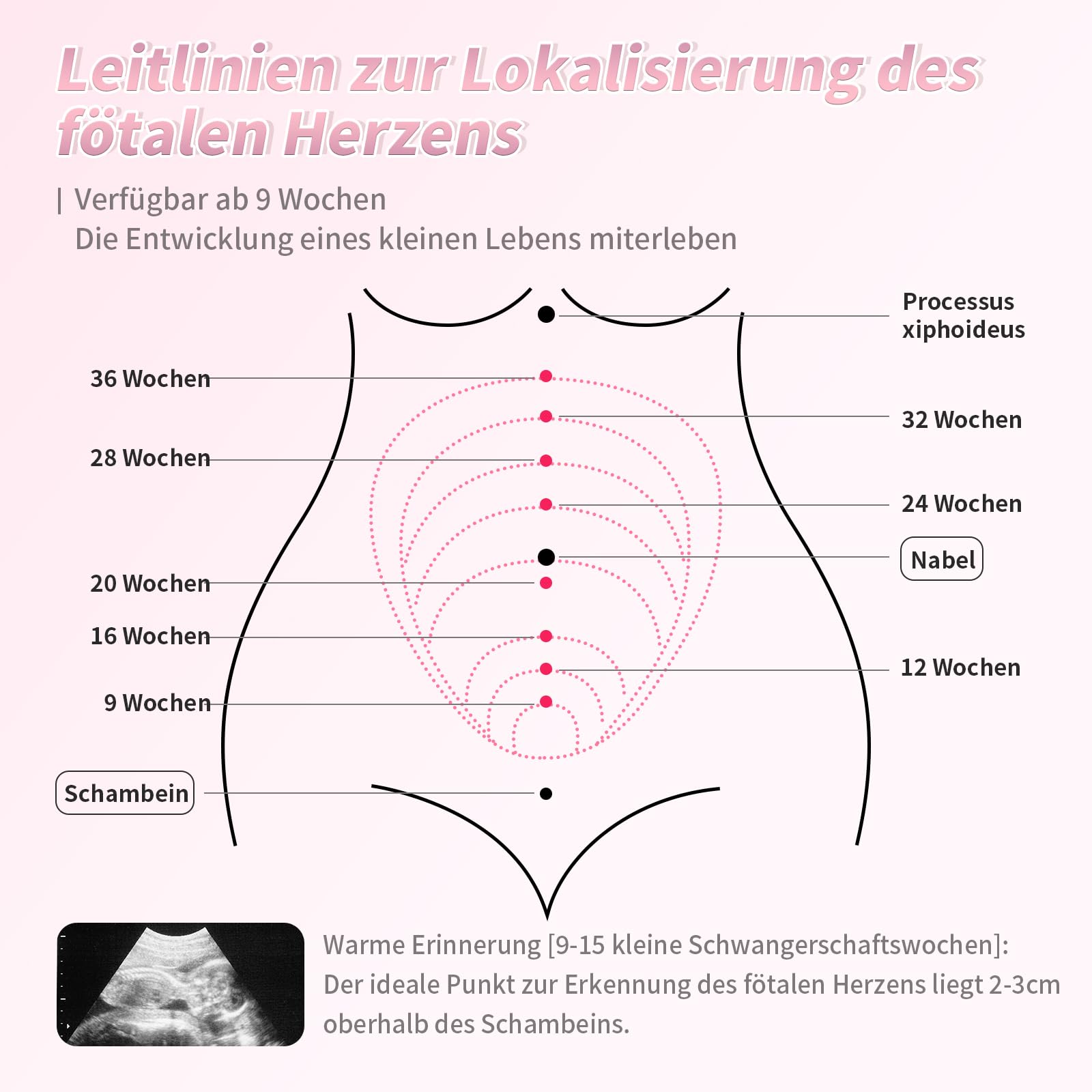 Hochempfindliche Sonde, mehrstufige Kompatibilität, kompakt und tragbar, langlebiger Akku, klare Audioqualität (Weiß)