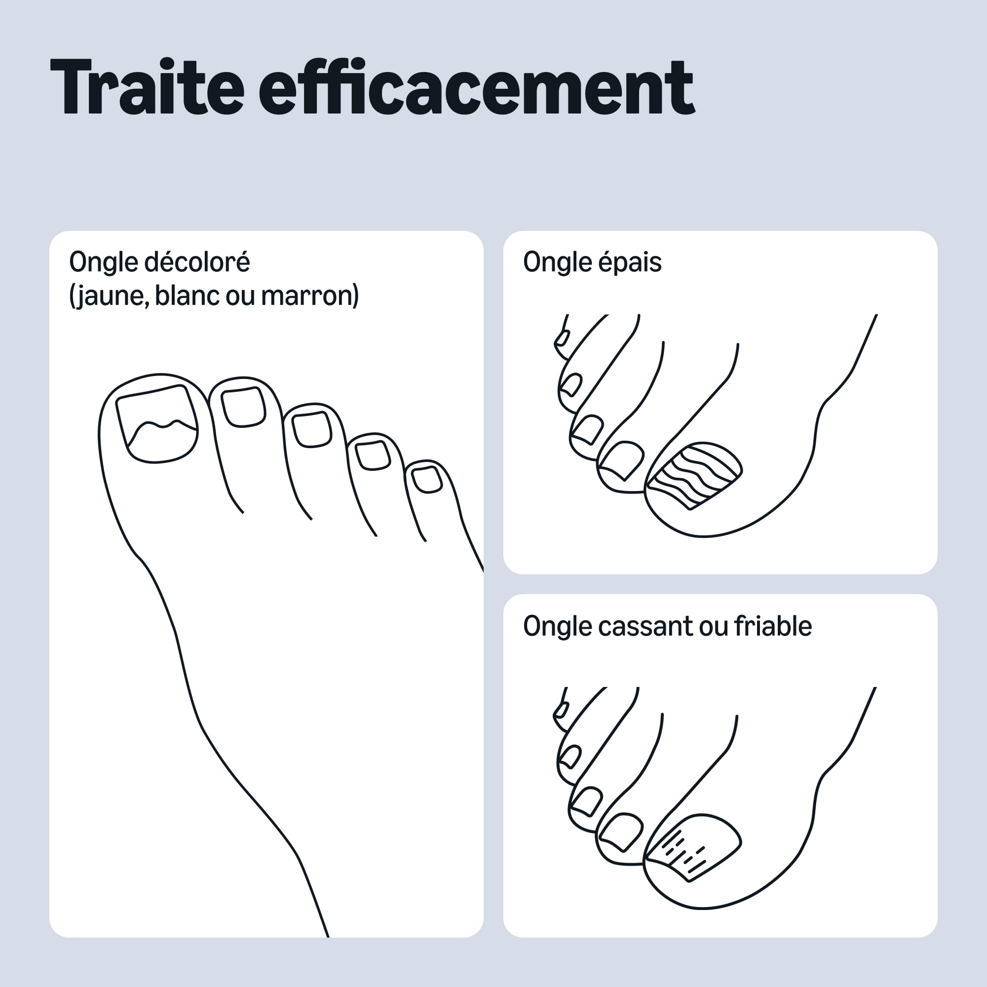 Healthcare by Amazon Liquide de Traitement Fongique pour les Ongles, 10ml (anciennement Amazon Basic Care) – L’emballage peut varier