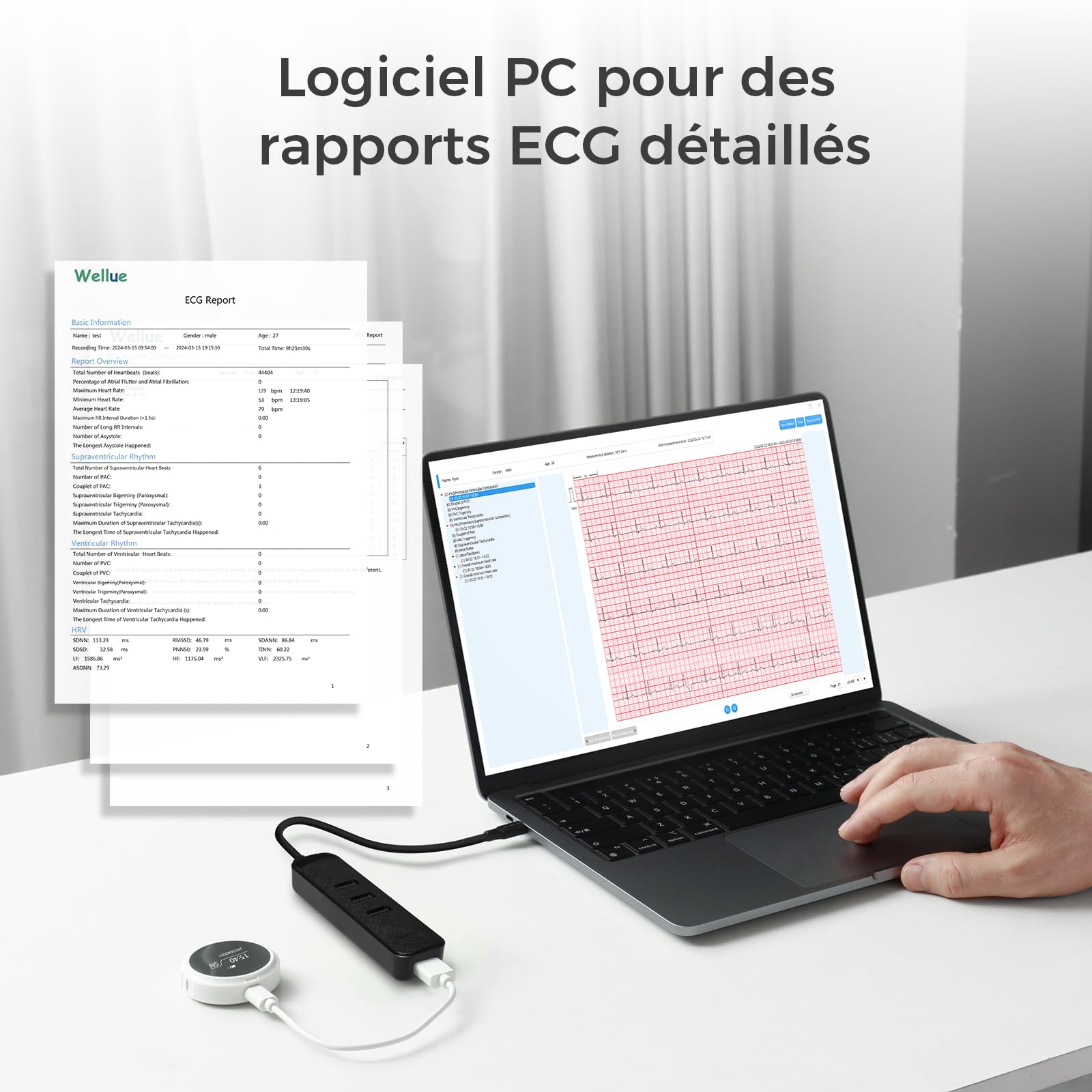 Wellue LP12 ECG portable 12 dérivations avec écran OLED, enregistrement de l'ECG en temps réel sur 24 heures, rapports AI ECG détaillés, marqueurs d'événements, Support pour Smartphone APP et PC