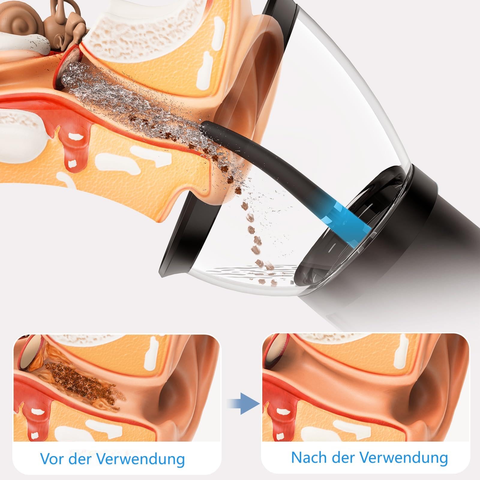 Elektrischer Ohrreiniger, Ohrenschmalz-Entferner mit 3 Modi und Spülfunktion, Wiederaufladbare Ohrdusche mit 200-ml-Wassertank, IPX7 wasserdicht