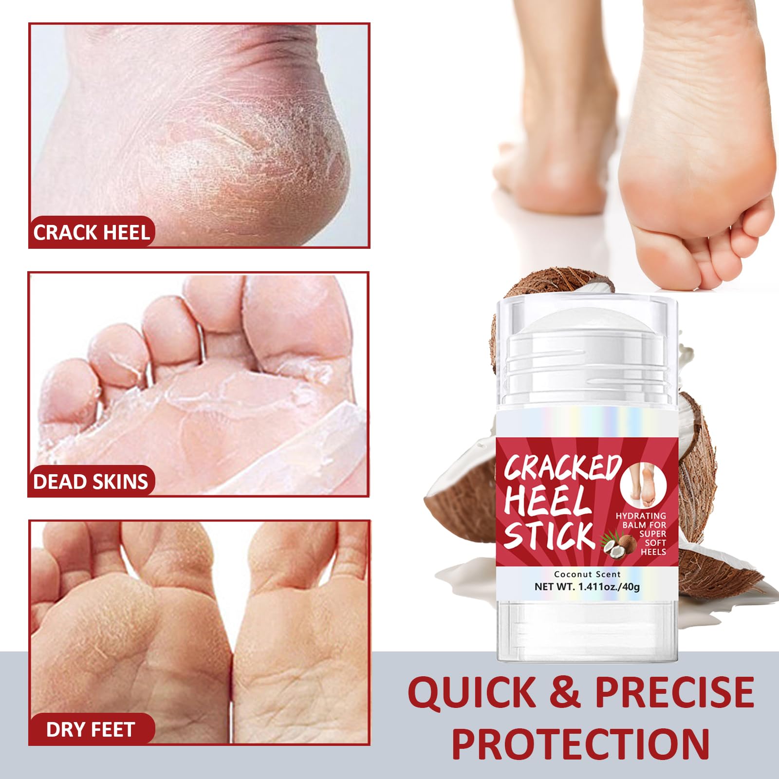 Foot Cream For Cracked Heels And Dry Skin- Foot Cream With Coconut Extract, Cracked Heel Balm With Coconut Oil - Image 3
