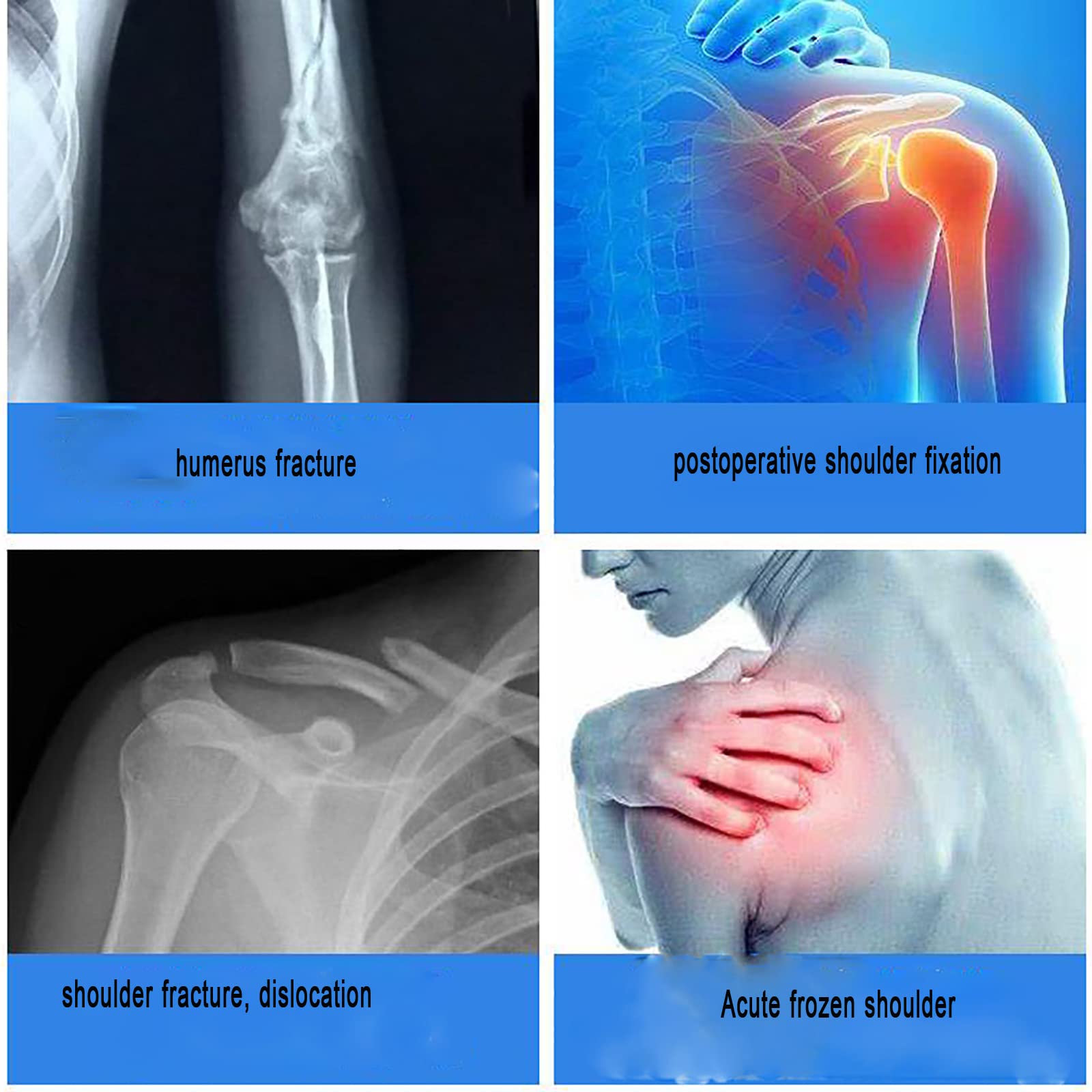 Soporte de fijación de fractura humeral ajustable, órtesis de abducción de hombro para adultos, soporte fijo de abducción de hombro, para fractura y dislocación humeral de la articulación del hombro