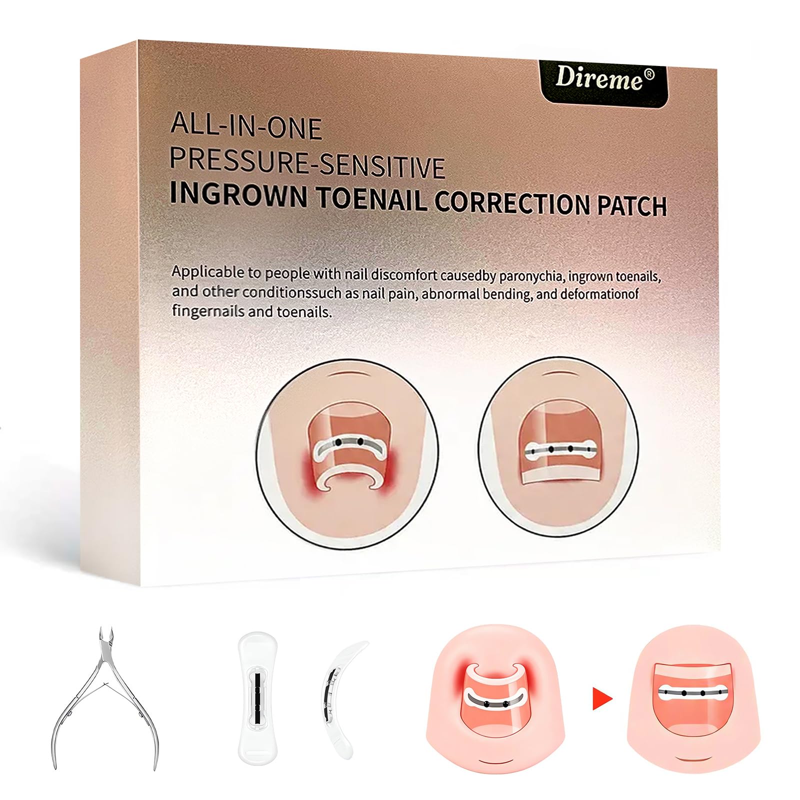 All-in-one Titanium Alloy Ingrown Toenail Corrector，Nail Tools