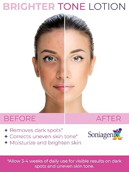 Brighter Tone Lotion Hyperpigmentation Treatment for Face Skin | Dark Spot and Uneven Skin Tone Corrector Moisturize and Brighten to correct visible spots Enhances Retinol Therapies