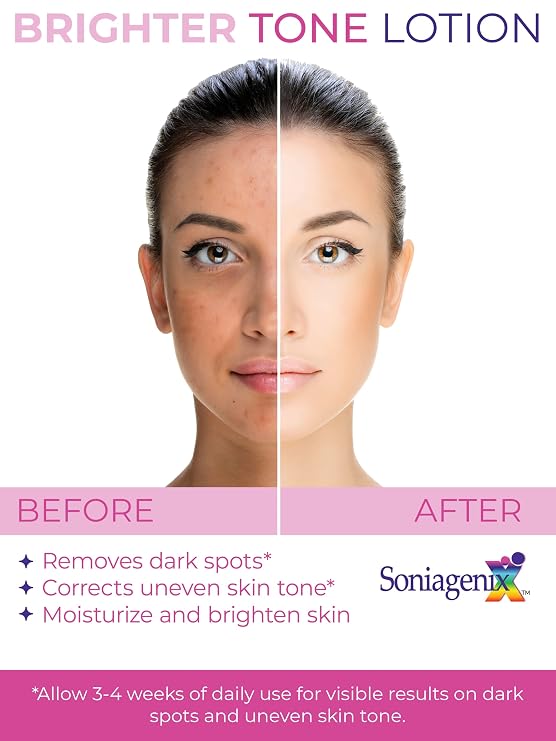 Brighter Tone Lotion Hyperpigmentation Treatment for Face Skin | Dark Spot and Uneven Skin Tone Corrector Moisturize and Brighten to correct visible spots Enhances Retinol Therapies