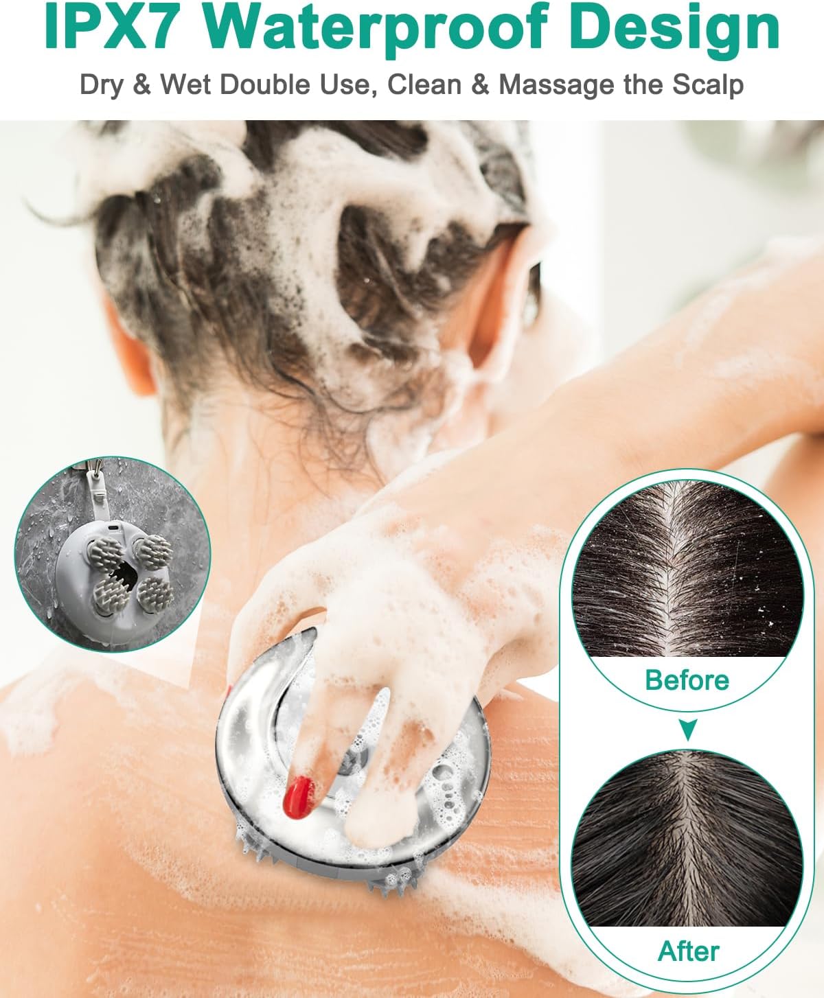 ORIA Electric Scalp Massager, Portable Head Massage Tool, Waterproof Hair Back Massager with Kneading, 4 Removable Claws, 76 Nodes, for Hair Growth, Stress Relax, Deep Clean