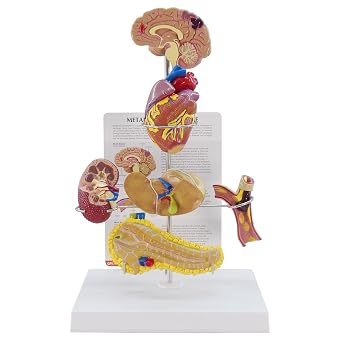 GPI Anatomicals - Metabolic Syndrome Model Set, Replica for Human Anatomy and Physiology Education, Anatomy Model for Doctors Offices and Classrooms, Medical Learning Resources