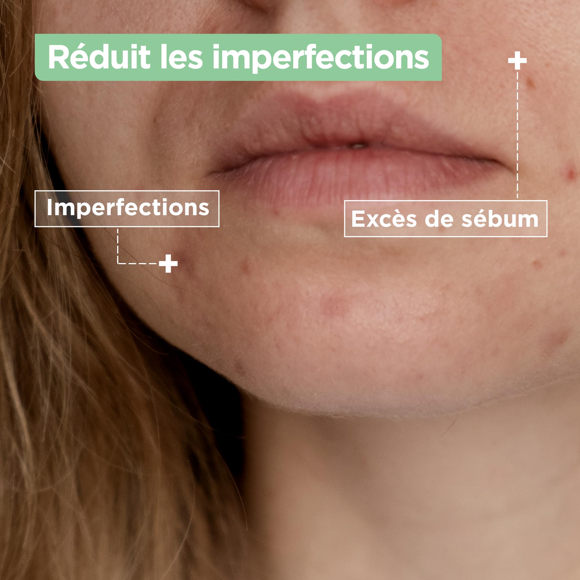 Mixa - Skoncentrowane serum przeciw niedoskonałościom + komfortowy środek czyszczący przeciw niedoskonałościom - z kwasem salicylowym i skwalanem - skóra niedoskonałościowa