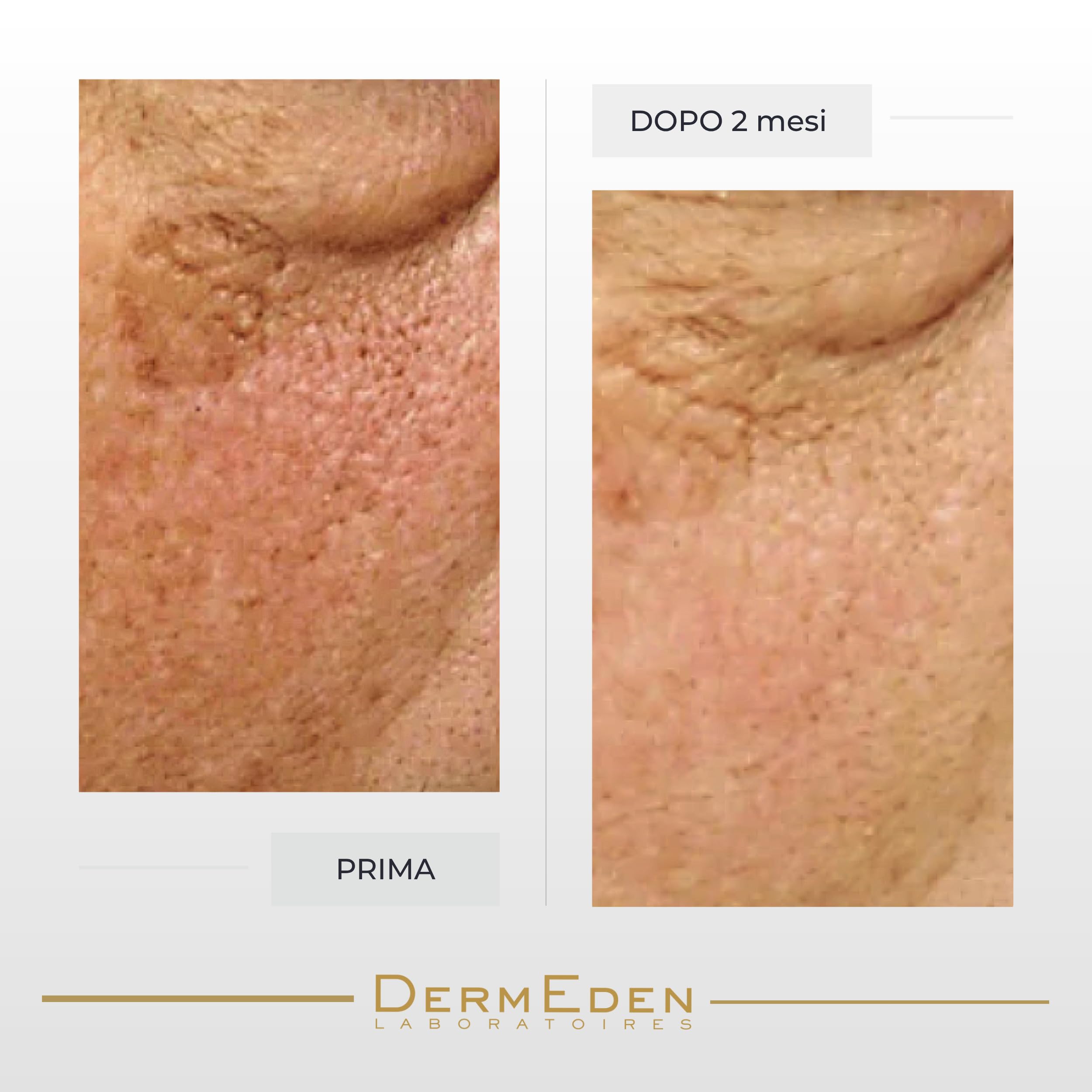 Laboratoires DermEden - Contorno occhi intenso 15 ml - Agisce su rughe, macchie e rilassamento cutaneo - Rispetta la fragilità del contorno occhi - Prodotto in Francia