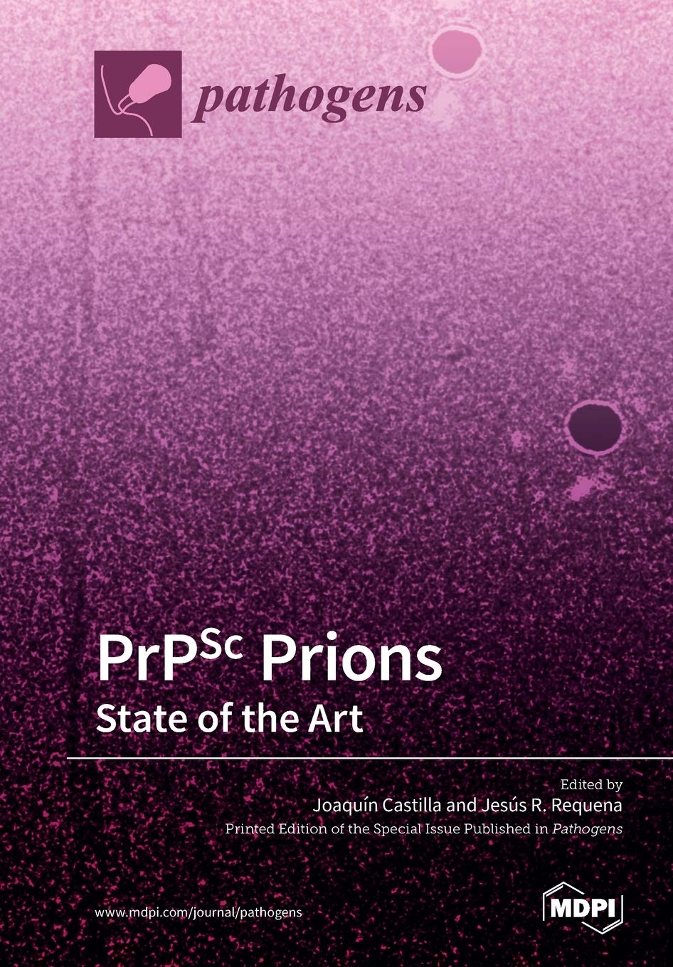 PrPSc Prions: State of the Art Paperback – Illustrated, 25 October 2018