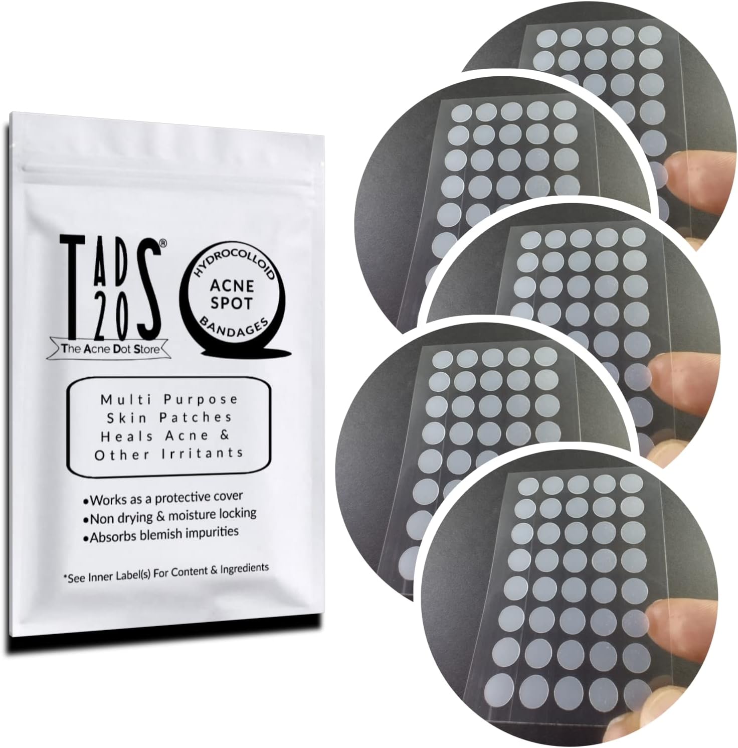 5pk, [200] Acne Dot Pimple Patches [SMALL SIZE] Cystic Acne Patch, FACE Spot Dots, Zit Sticker, Hydrocolloid Bandages, Blemish Spot Treatment, tads20