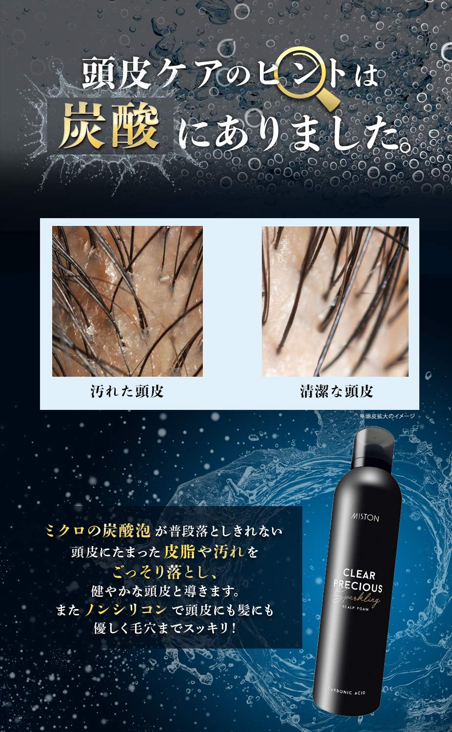 クリアプレシャス　スカルプフォーム 320g  3本セット Amazon | MISTON 炭酸シャンプー クリアプレシャス スカルプフォーム