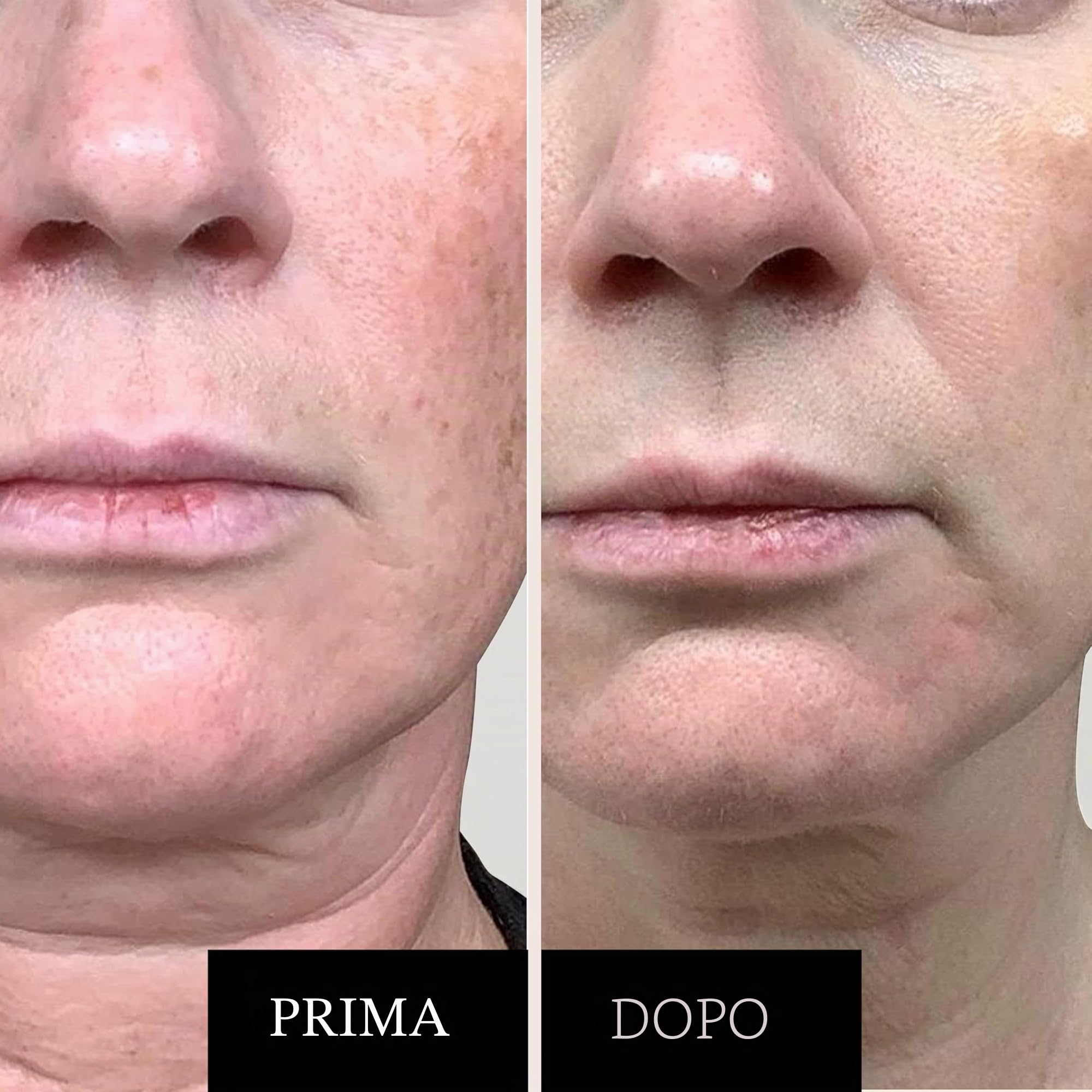 Set Anti-Aging per il Viso: Siero alla Vitamina C e Crema al Retinolo – Confezione Regalo Biologica per Donna per Ridurre Rughe, Macchie Scure, Incarnato Non Uniforme e Promuovere una Pelle Giovane