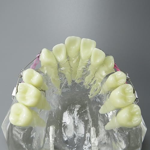 Miniatura 6 de Modelo dental de los dientes del tratamiento de ortodoncia de la maloclusión con los soportes del metal Alambres Cadenas y aros coloridos de los