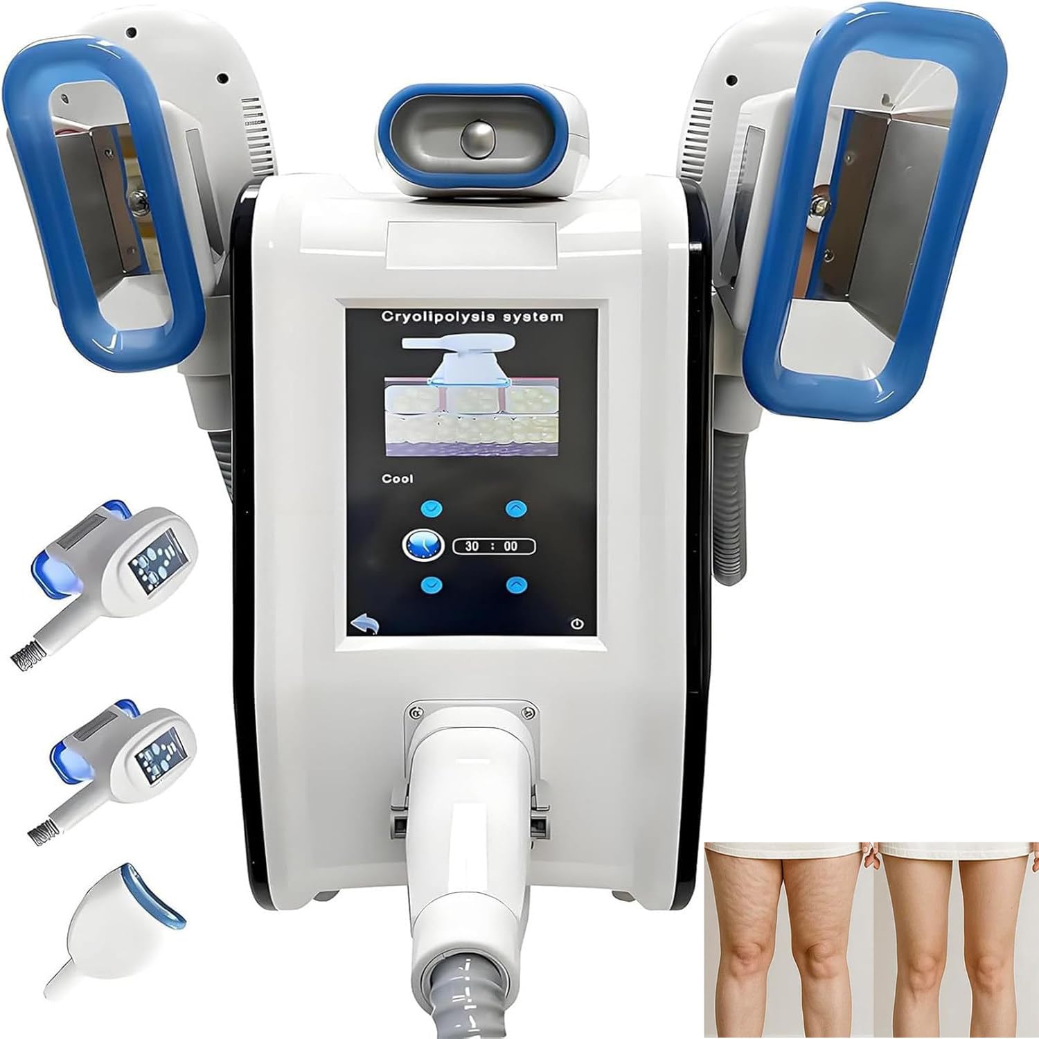 Esculpidor Criolipólisis de Grasa con Criolipólisis por Cavitación RF - Máquina de Lipólisis por Congelación de Grasa por Criolipólisis para Esculpir Abdomen, Cintura, Muslos, Brazos y Papada