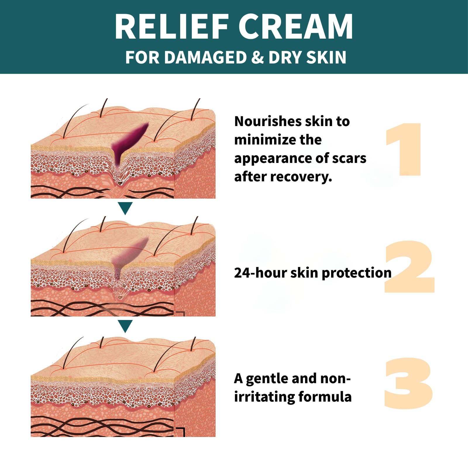 Repail Cream Skin Repair Cream,Relief Cream for Damaged & Dry Skin, Scar Fading ...