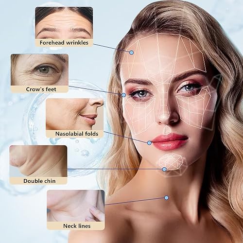 Miniatura 8 de Oldream Pdo Threads 30G25mm, hilos Pdo para elevación facial, roscas de tornillo Pdo, Pdo, elevación facial de rosca, rosca Pdo, 20 unidades