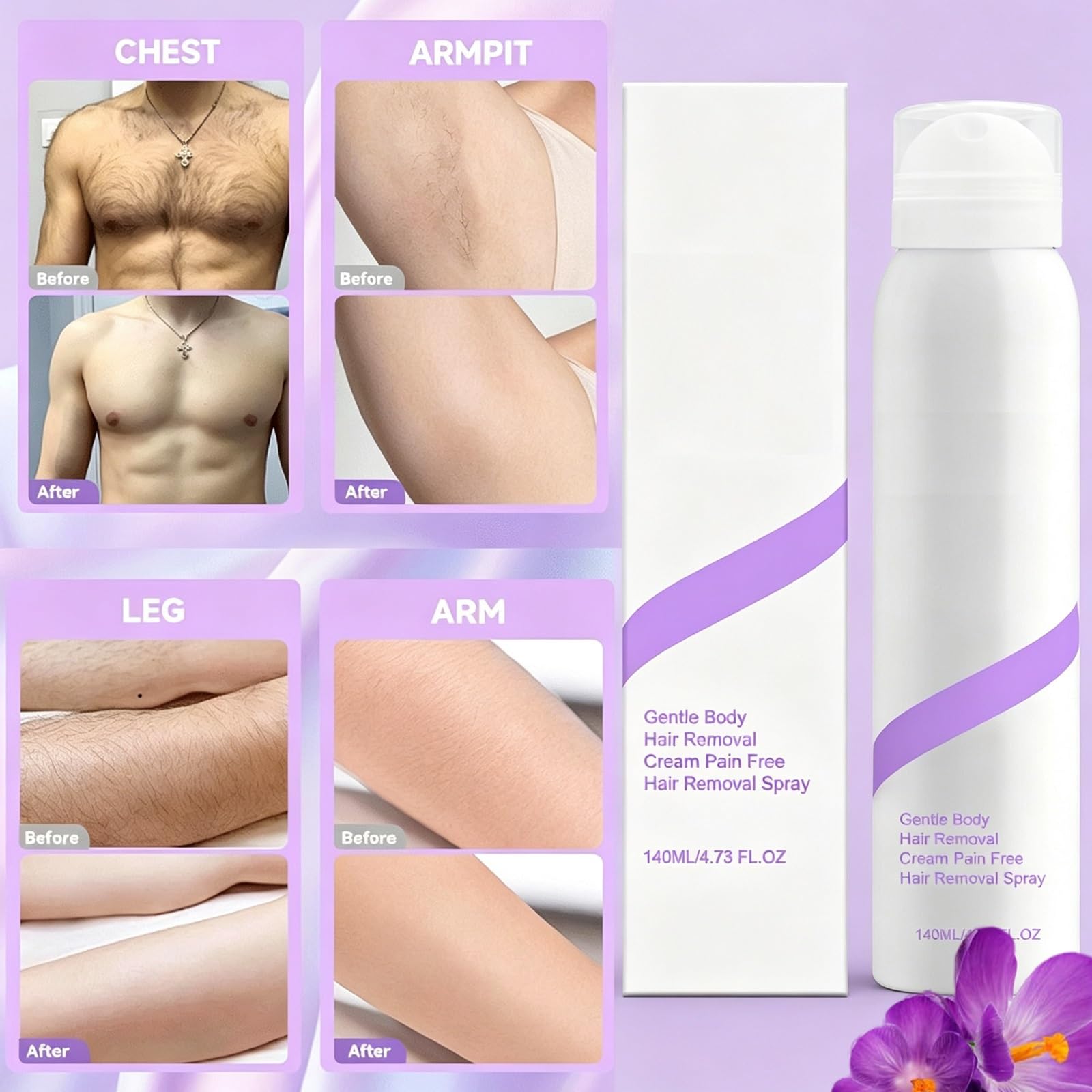 Haarentfernungsspray, Indolore Bikini-Haarentfernungsspray, Haarentfernungscreme Per Pelli Sensibili, Haarentfernungscreme Per Spazi Privati (5pcs)