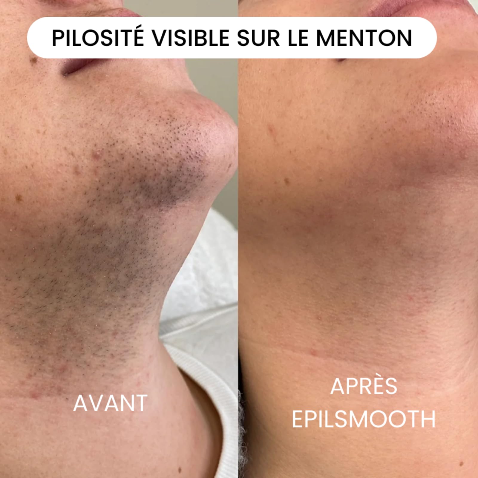 Klyne EpilSmooth Pro，Épilateur Électrique 2-en-1 Rechargeable pour Femmes avec Lumière LED, Tête de Remplacement Offerte,Épilation douce，Convient pour l'épilation complète du corps