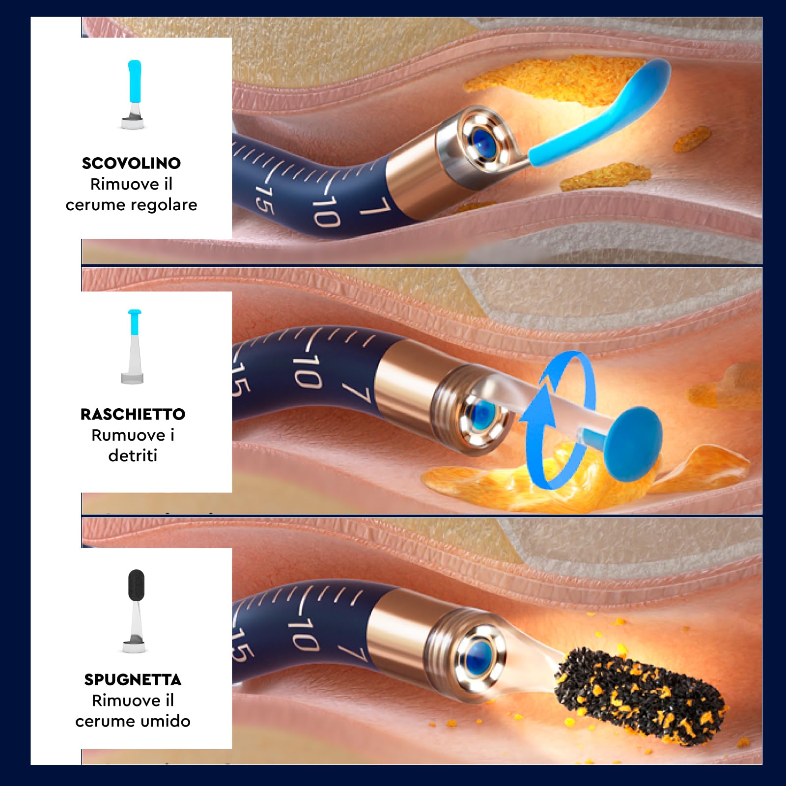 Otoscopio Pulizia Orecchie Multifunzione UdiGuard Pro-Clean - Versatile e Ideale per Pulizia e Rimozione del Cerume - Flessibile Impermeabile Digitale con Corpo in Silicone e Telecamera HD