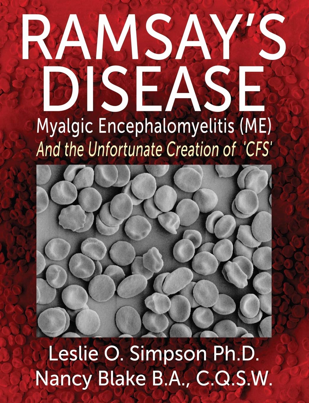 Ramsay's Disease - Myalgic Encephalomyelitis (ME) and the Unfortunate Creation of 'CFS'