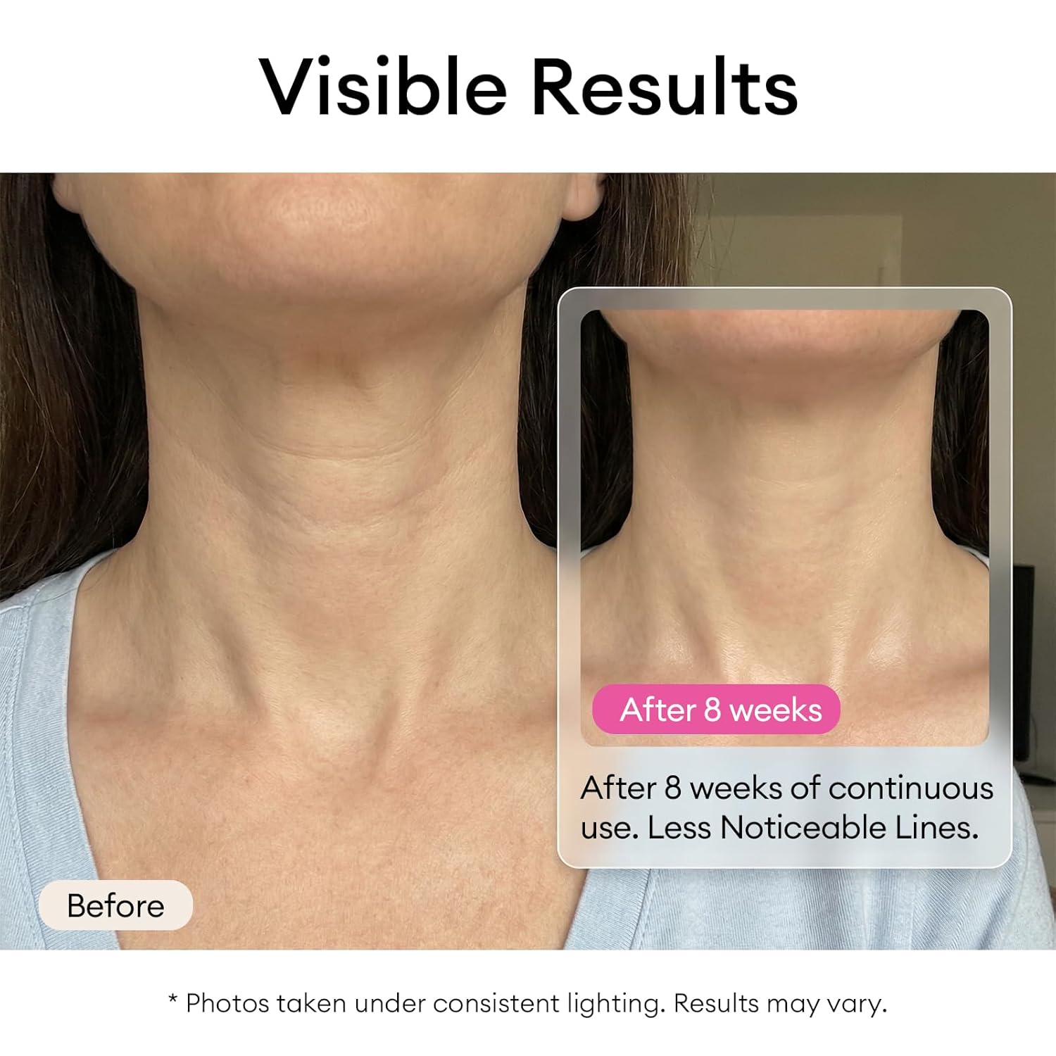 EXH Neck Wrinkle Patches for Tightening and Firming - Collagen Neck Mask with Black Ganoderma Polypeptide - Hydrating Neck Firming Mask for Crepey Skin & Tech Neck (10 Sheets) - Image 3