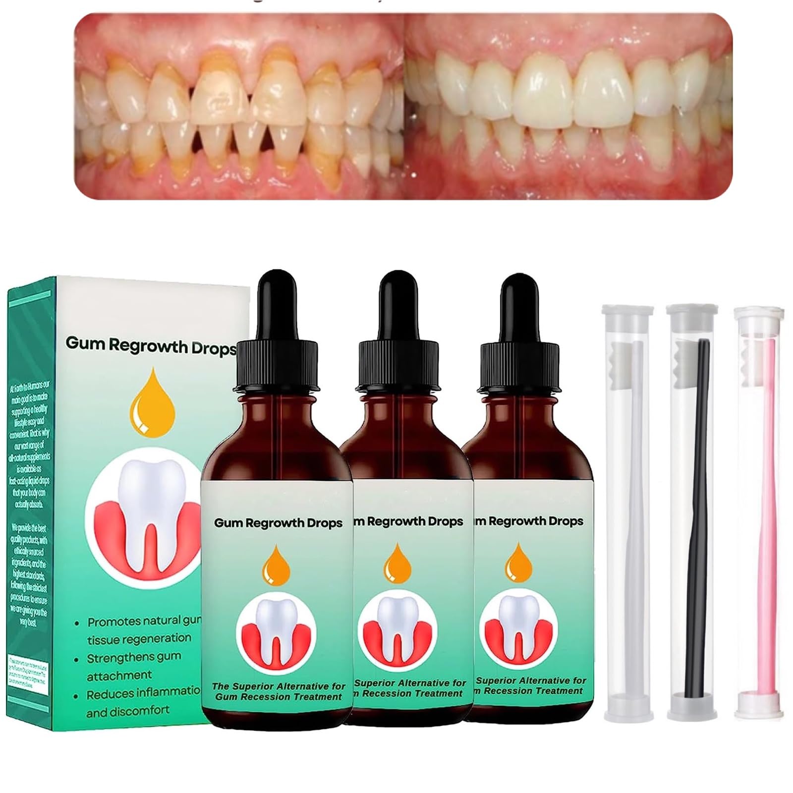 Oil Pulling Cavities