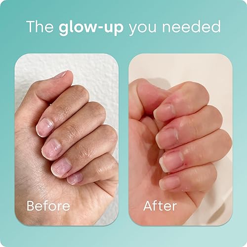 Miniatura 4 de Biosil Suplemento potenciador de colágeno - 180 cápsulas líquidas - Activador patentado ch-OSA para piel, cabello, uñas y articulaciones - Apoya la