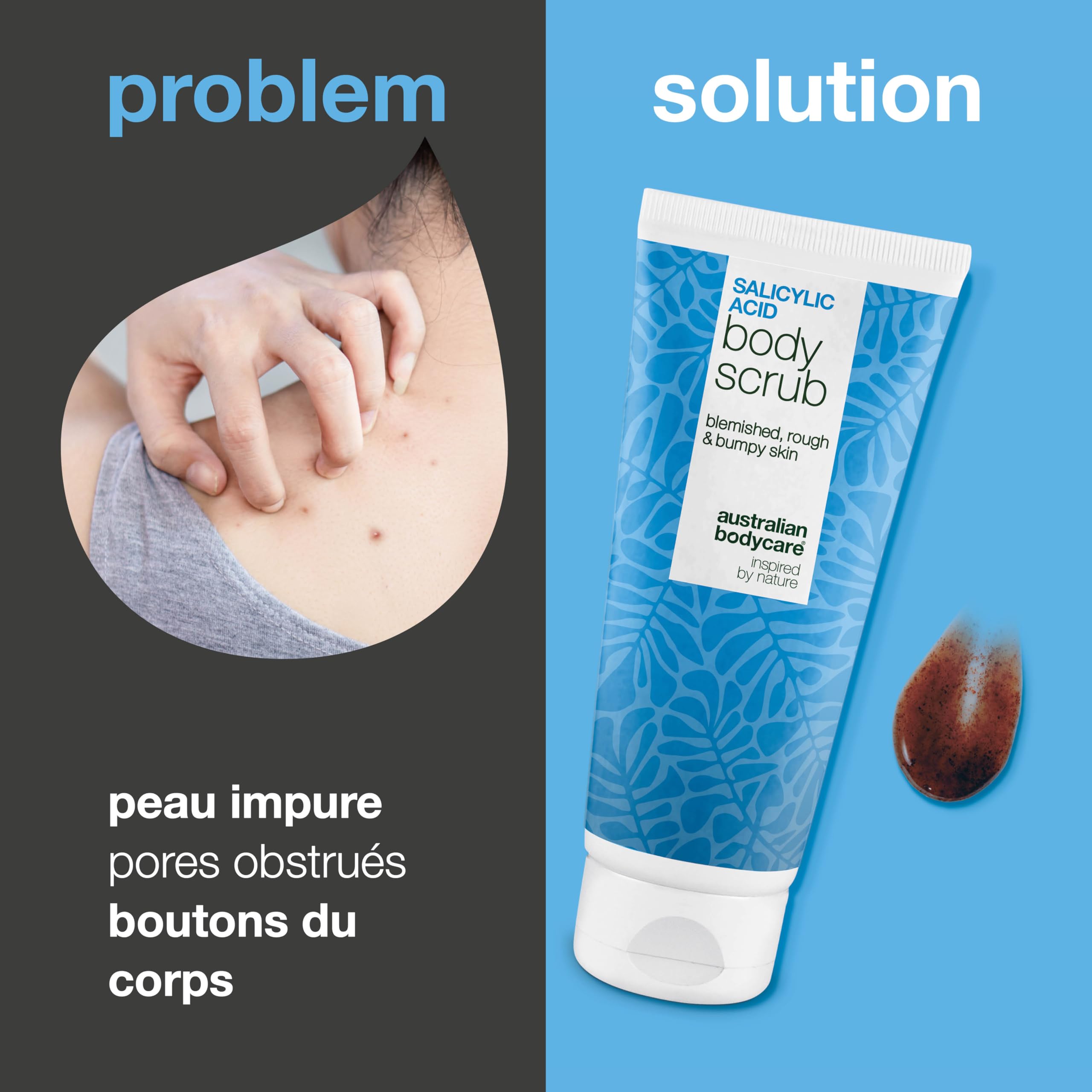 Gommage corps à l’acide salicylique pour les boutons sur le corps, le dos, la poitrine et les fesses – peeling anti-imperfections & pores dilatés avec acide salicylique (BHA) et acide glycolique (AHA)