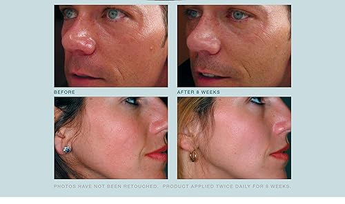 Miniatura 4 de Crema facial antienvejecimiento, triple antioxidante, suero de tratamiento para cara, resveratrol + té verde + cafeína, reduce visiblemente el