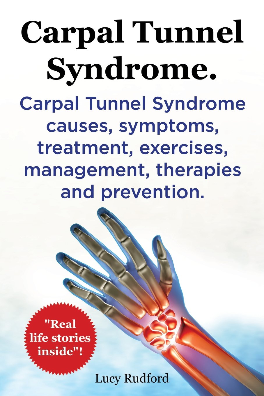 Carpal Tunnel Syndrome. Carpal Tunnel Syndrome causes, symptoms, treatment, exercises, management, therapies and prevention. Real Life Stories Inside!.