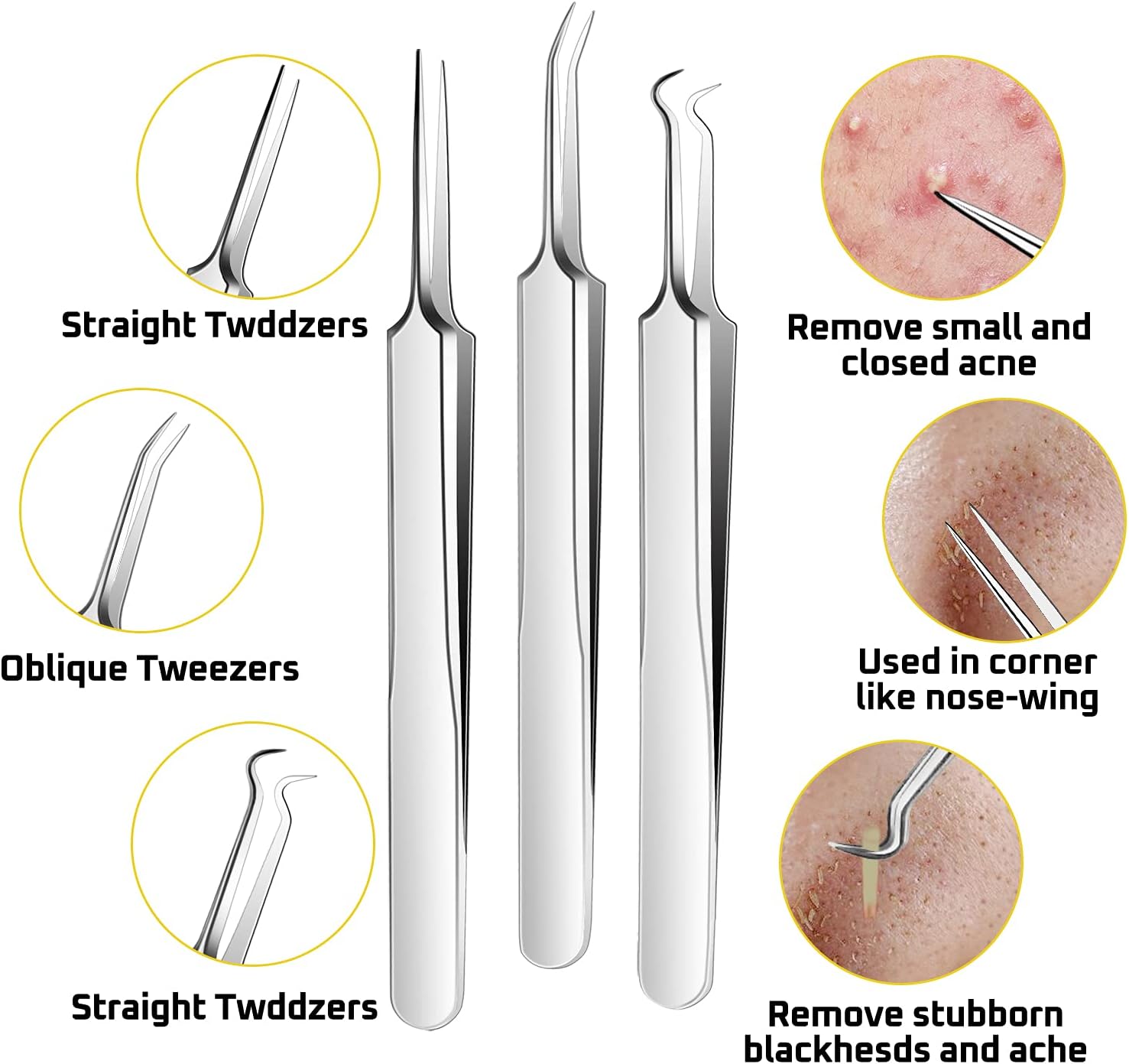 BAbuGIG Pimple Popper Tool Kit,Acne Removal Tool kit 11 Pcs Remover Comedone Extractor for Quick and Easy Removal of Pimples, Blackheads for Acne Blemish Removal (Silver-11) : Beauty & Personal Care
