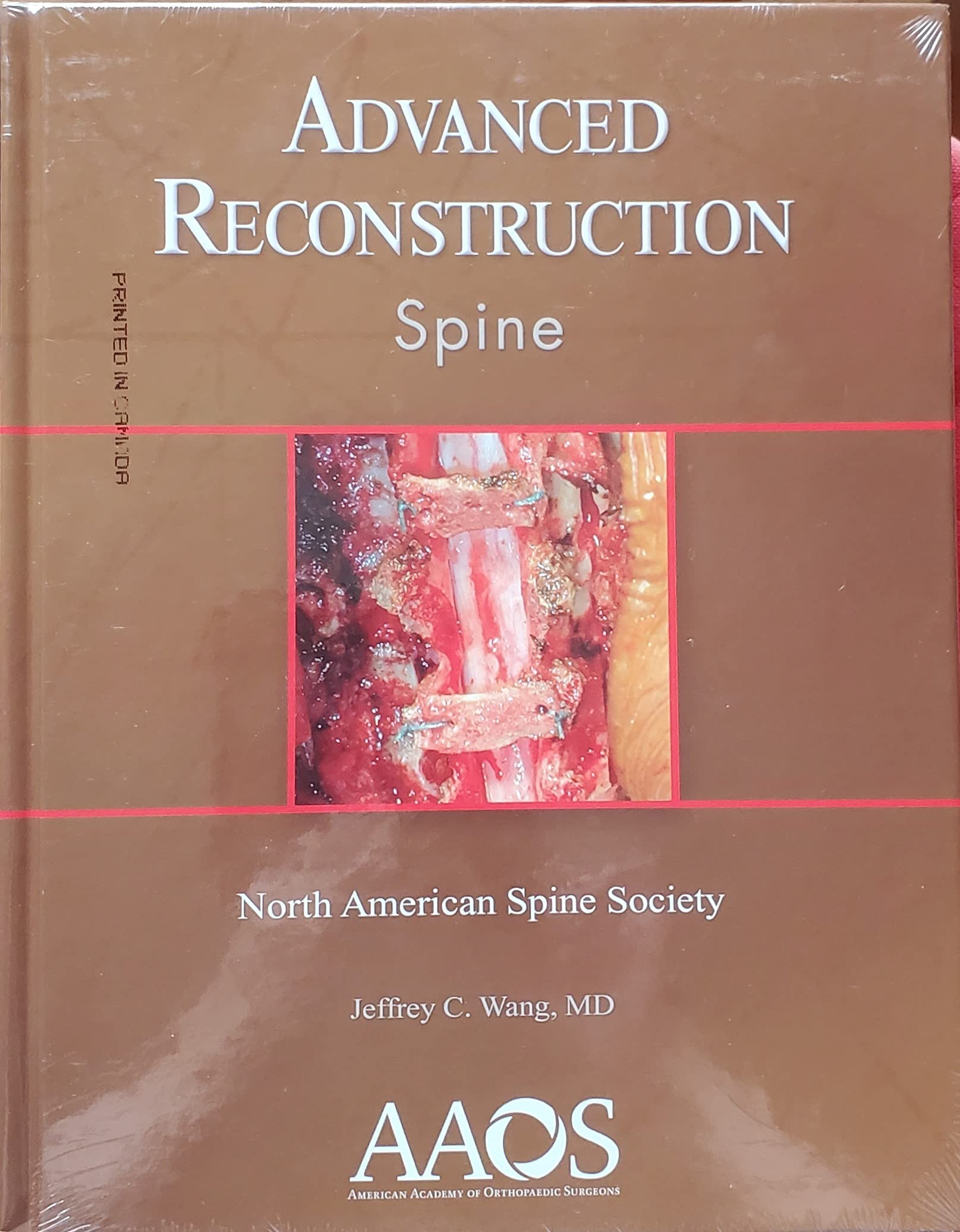Advanced Reconstruction: Spine