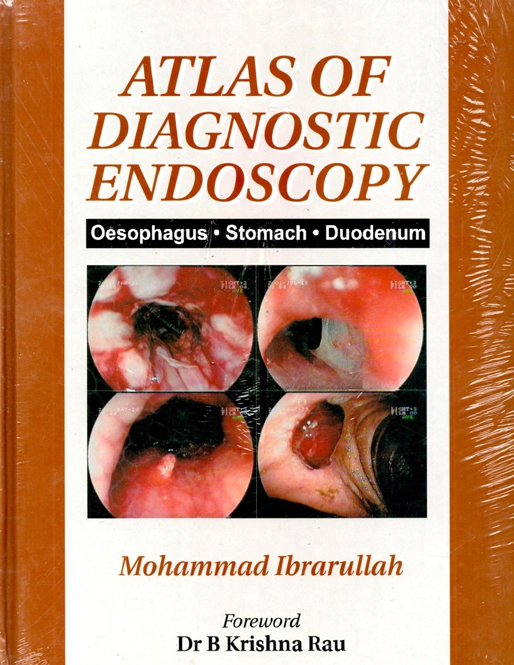 Buy Atlas of Diagnostic Endoscopy Book Online at Low Prices