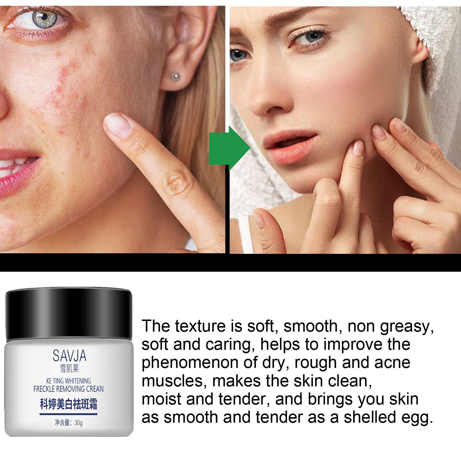 1/2/3/5pcs Dark Spot Remover For Face,Spot Cream Hyperpigmentation Treatment,Dark Spot Corrector Cream Age Spot Remover For Face,Freckle Remover For Sun Spots,Pigmentation Treatment Skincare (5pcs)
