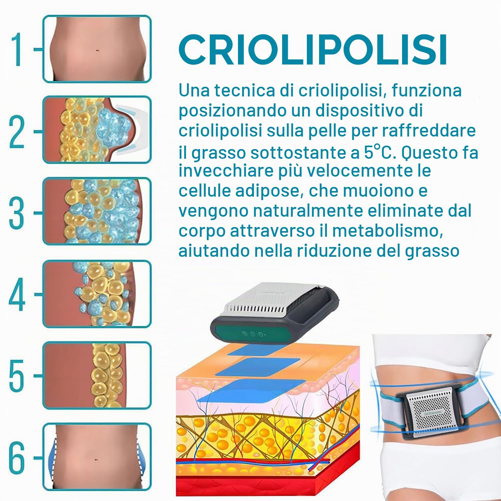 Congelatore di Grasso Domestico, Macchina per La Criolipolisi per Modellare Il Corpo, Timer da 30min/60min, Brucia Grassi Addominali, per Addome, Braccia, Cosce, per Uomini E Donne
