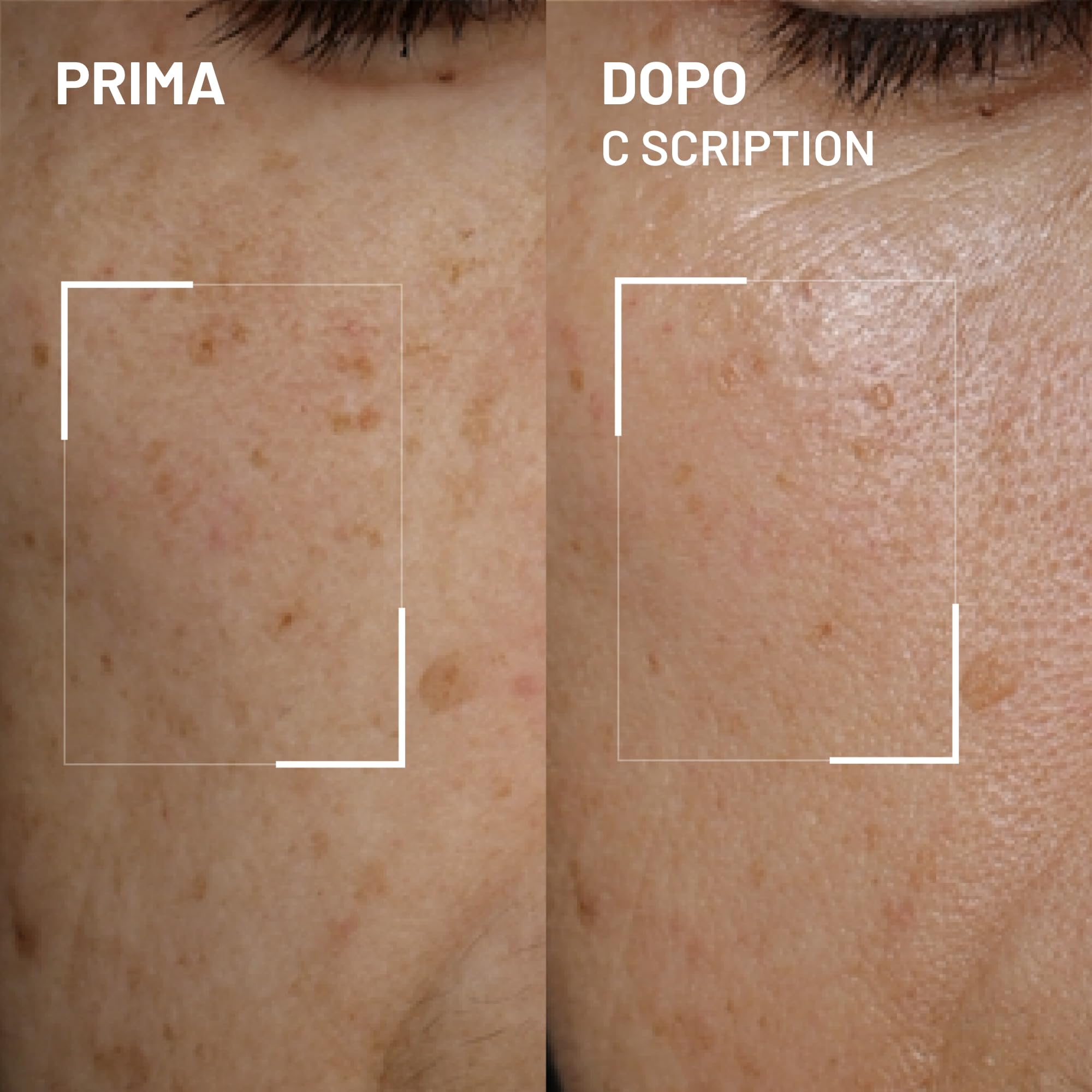 Dr. Brandt Bright This Way C Scription - Siero concentrato alla vitamina C - Attenua le macchie scure, riduce le rughe e illumina il tono della pelle - 30 ml
