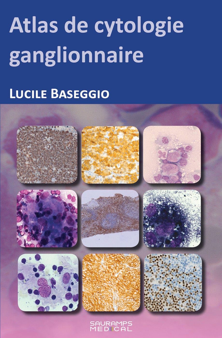ATLAS DE CYTOPATHOLOGIE GANGLIONNAIRE