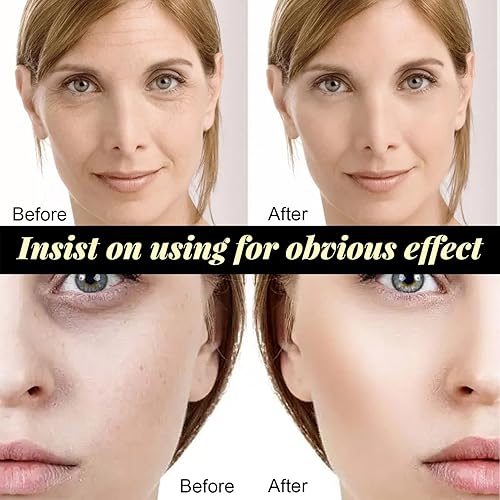 Miniatura 4 de Protein Thread Lifting Set Absorbable Collagen Thread Lifting Firming Facial Serum Combination for Face Lift Reduce Fine Lines