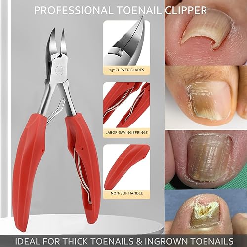 Miniatura 2 de Cortador de uñas encarnadas, cortador de uñas, cuchillo de pedicura para uñas gruesas, tratamiento de corrección de uñas de los pies, cuchillo de