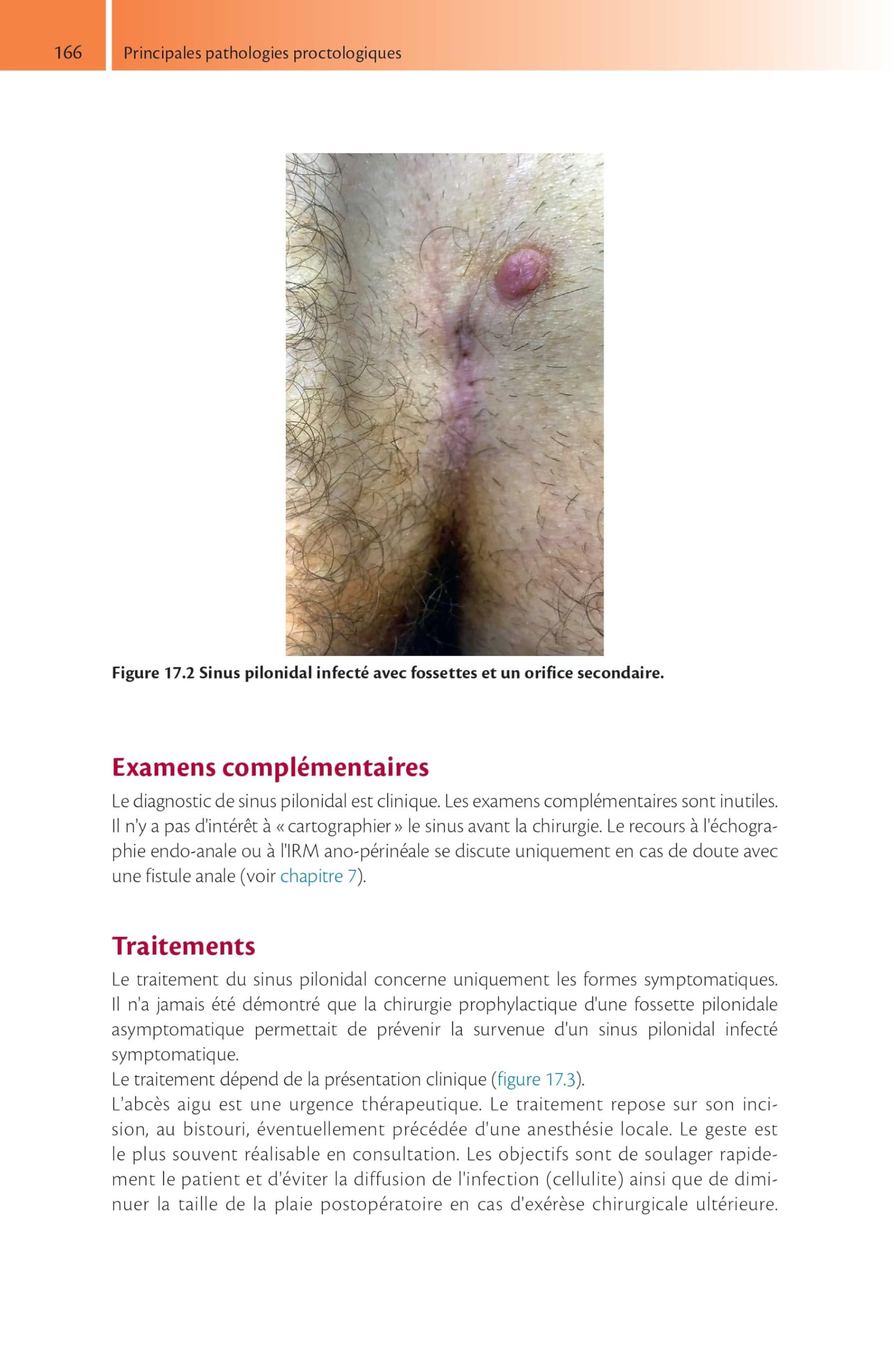 Tout-en-un de proctologie