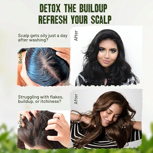 Miniatura 5 de Herbishh Barra de champú Tea Tree & Mint - Barra de jabón de aceite de árbol de té para limpieza de cabello graso y cuero cabelludo - Champú sólido