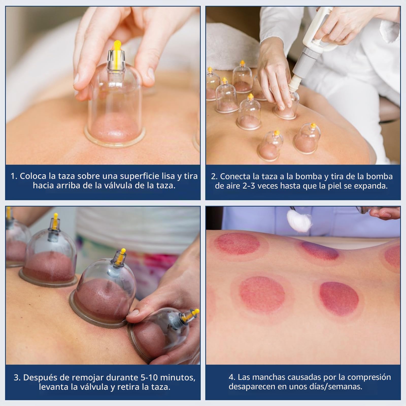 22 PCS Juego de ventosas de plástico con bomba de vacío, ventosas fisioterapia para masaje, ventosas, espalda, cuello, anticelulitis, accesorios para terapia de ventosas
