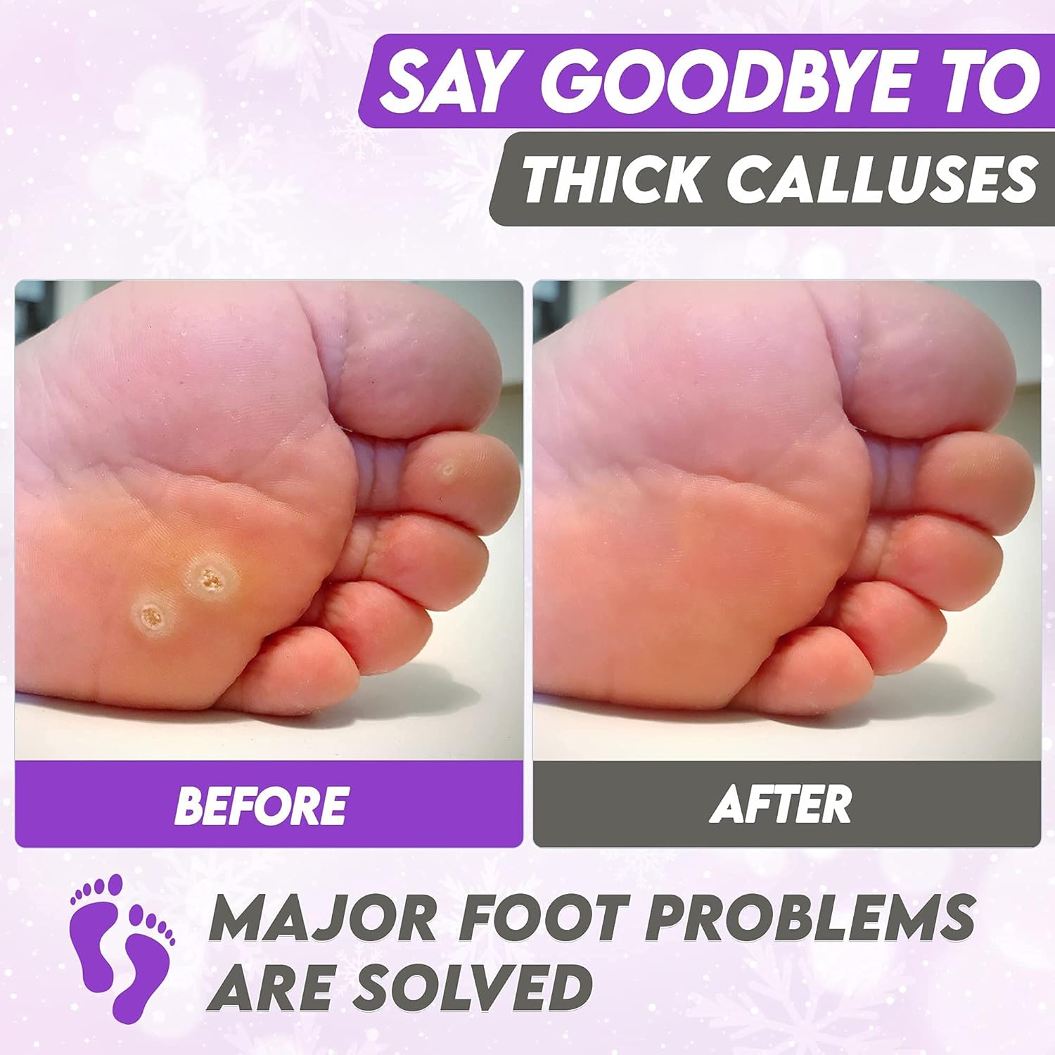 Karma Organic Lavender Nail Polish Remover & 2 Pack Lavender Exfoliating Foot Peel Mask | non toxic vegan cruelty free | Foot Peel Mask For Cracked Heels, Dead Skin & Calluses - Removes & Repairs Roug