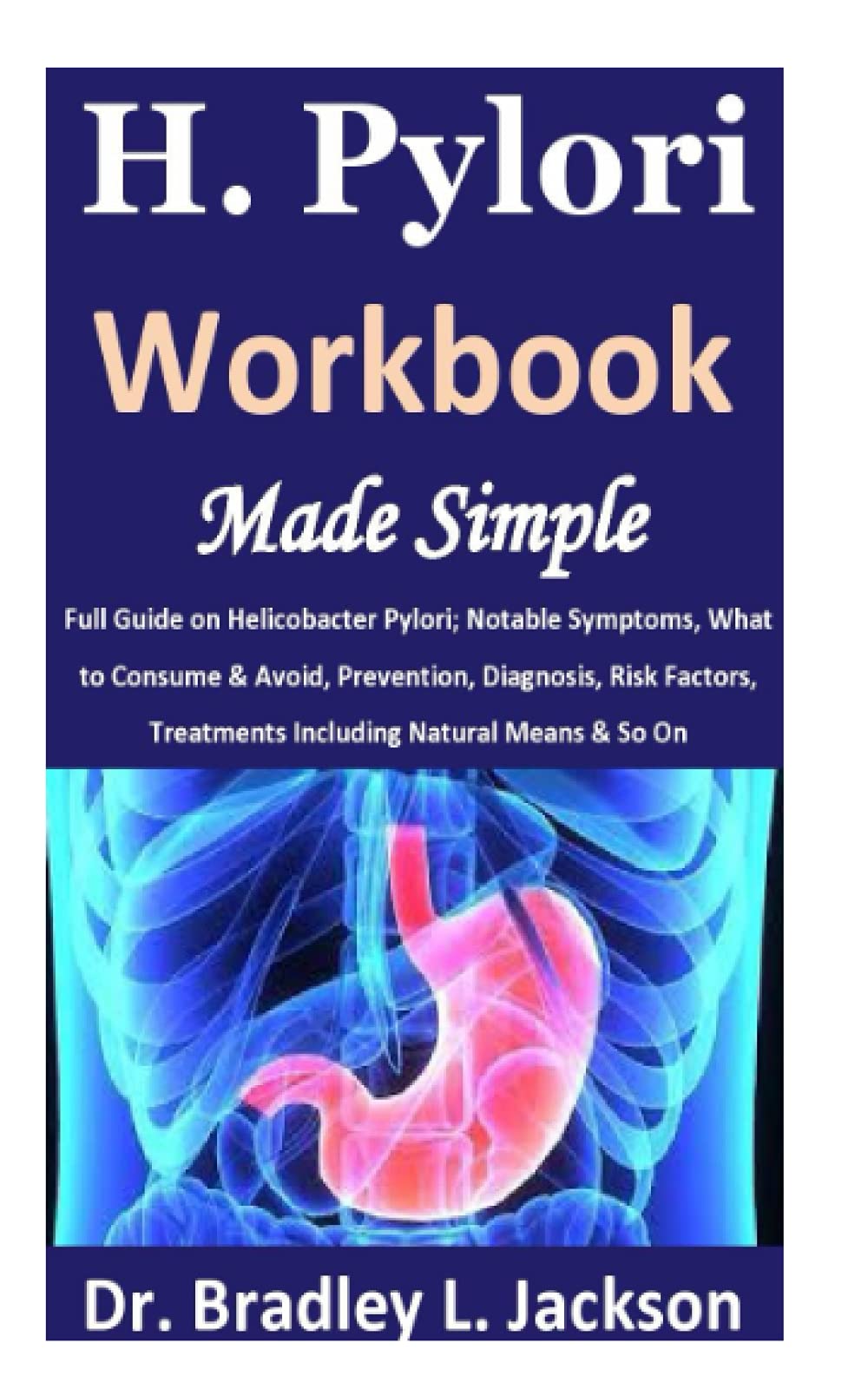 Buy H. Pylori Workbook Made Simple Full Guide on Helicobacter Pylori